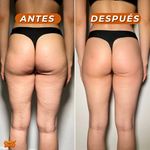 Masajeador y Tonificador Reafirmante para Glúteos (Lleva 2 Paga 1)