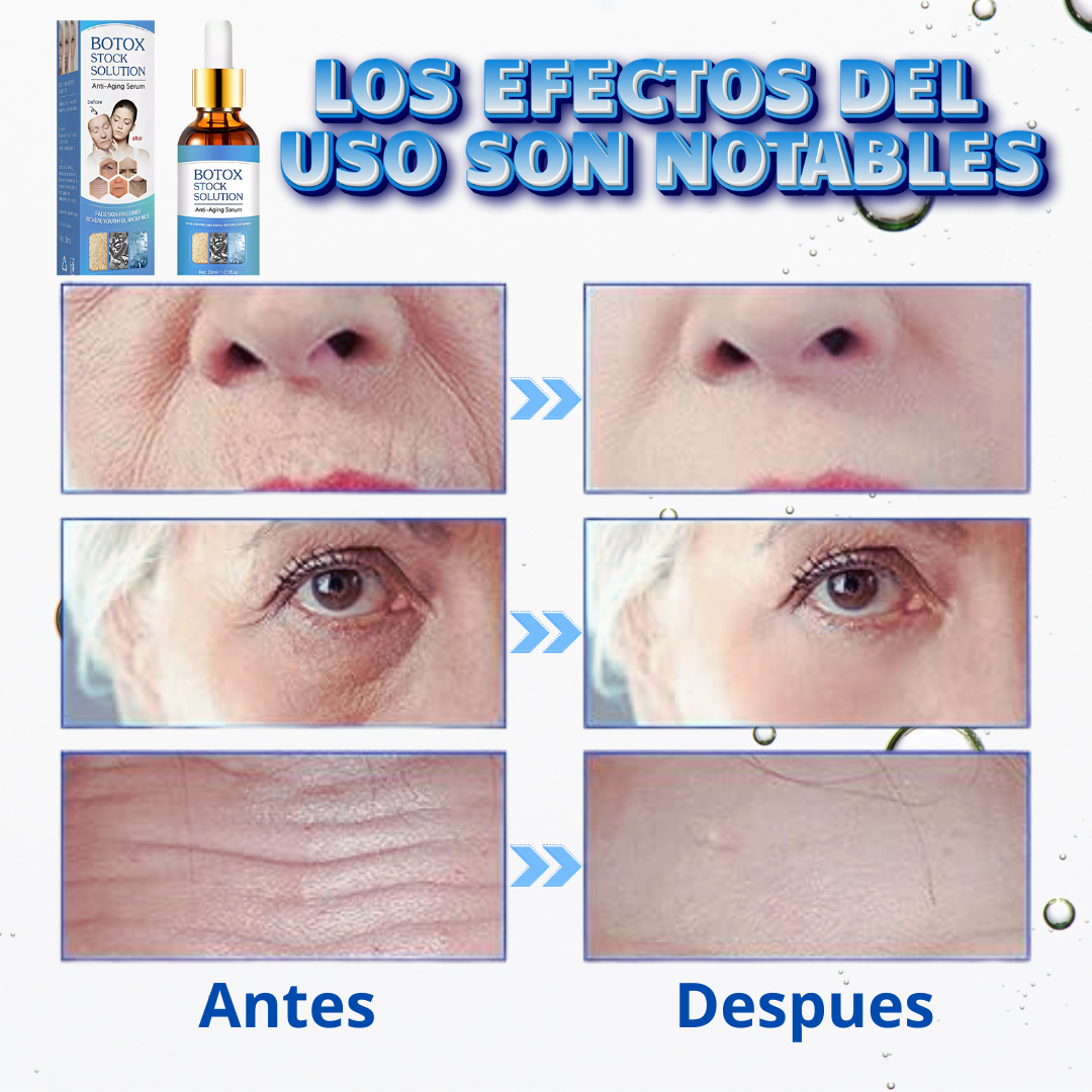 Botox Suero Antiarrugas - Promoción 70% OFF🎁