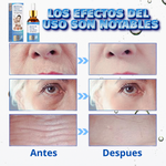 Botox Suero Antiarrugas - Promoción 70% OFF🎁
