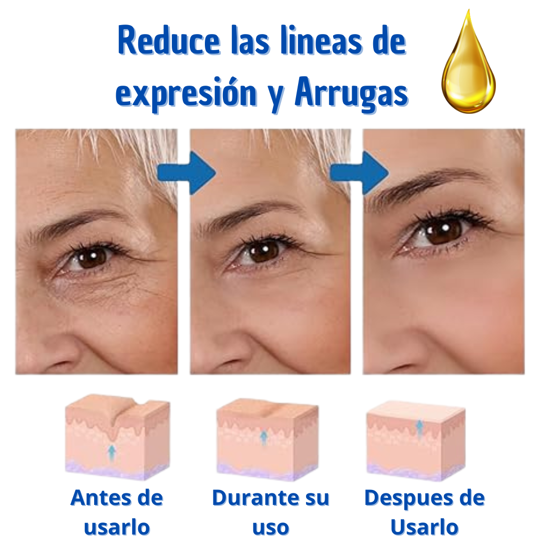 Botox Suero Antiarrugas - Promoción 70% OFF🎁