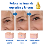 Botox Suero Antiarrugas - Promoción 70% OFF🎁