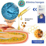 OFERTA 2X1 🍃 Tratamiento SIN DOLOR! Antihongos para Uñas- Nail Fungus Essence   🍃